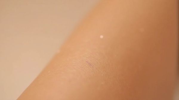 L'épilation laser pour femme : une solution durable et efficace